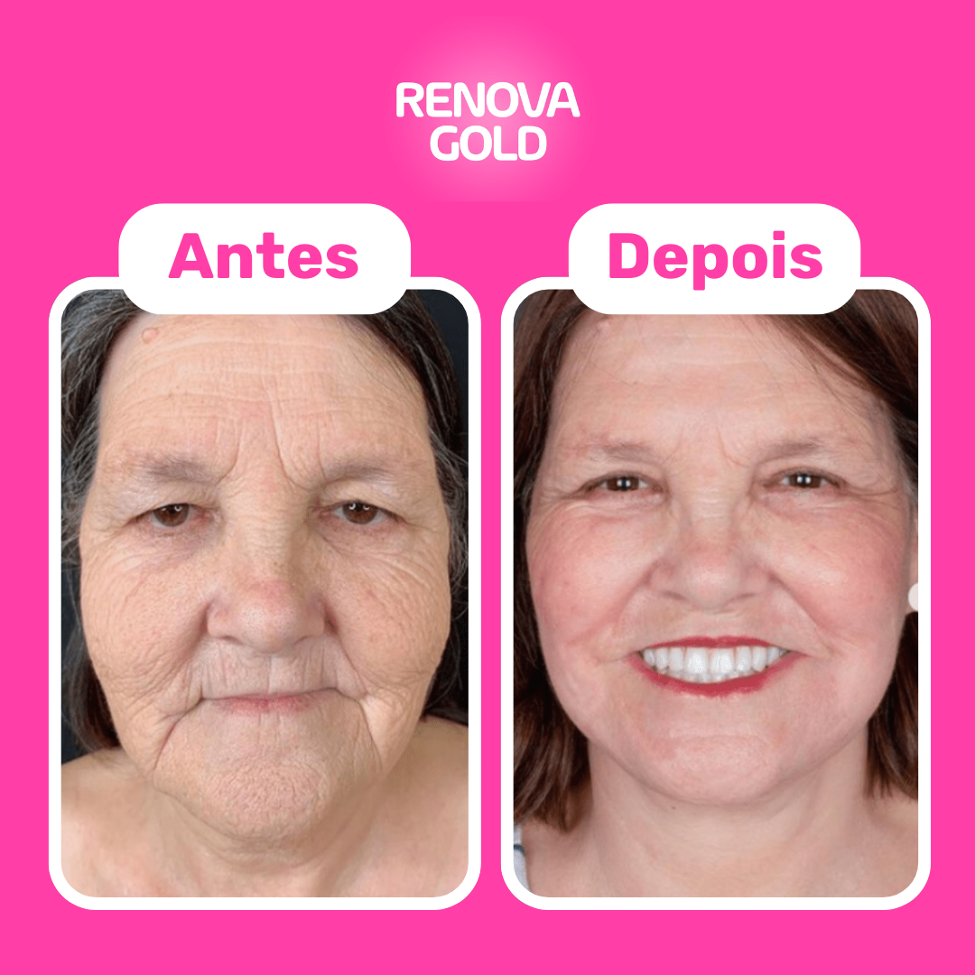 renova-gold-antes-depois-cliente